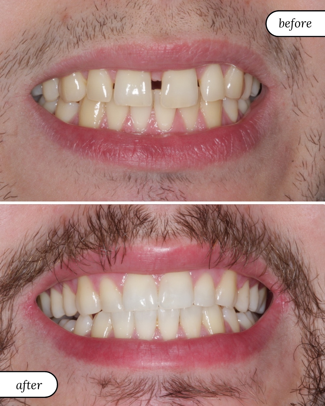 Smile Gallery