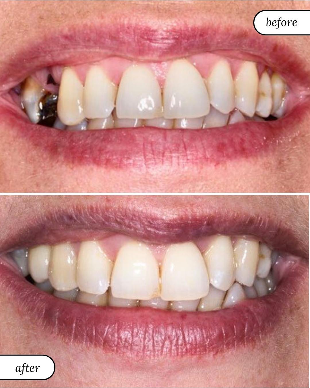 Smile Gallery