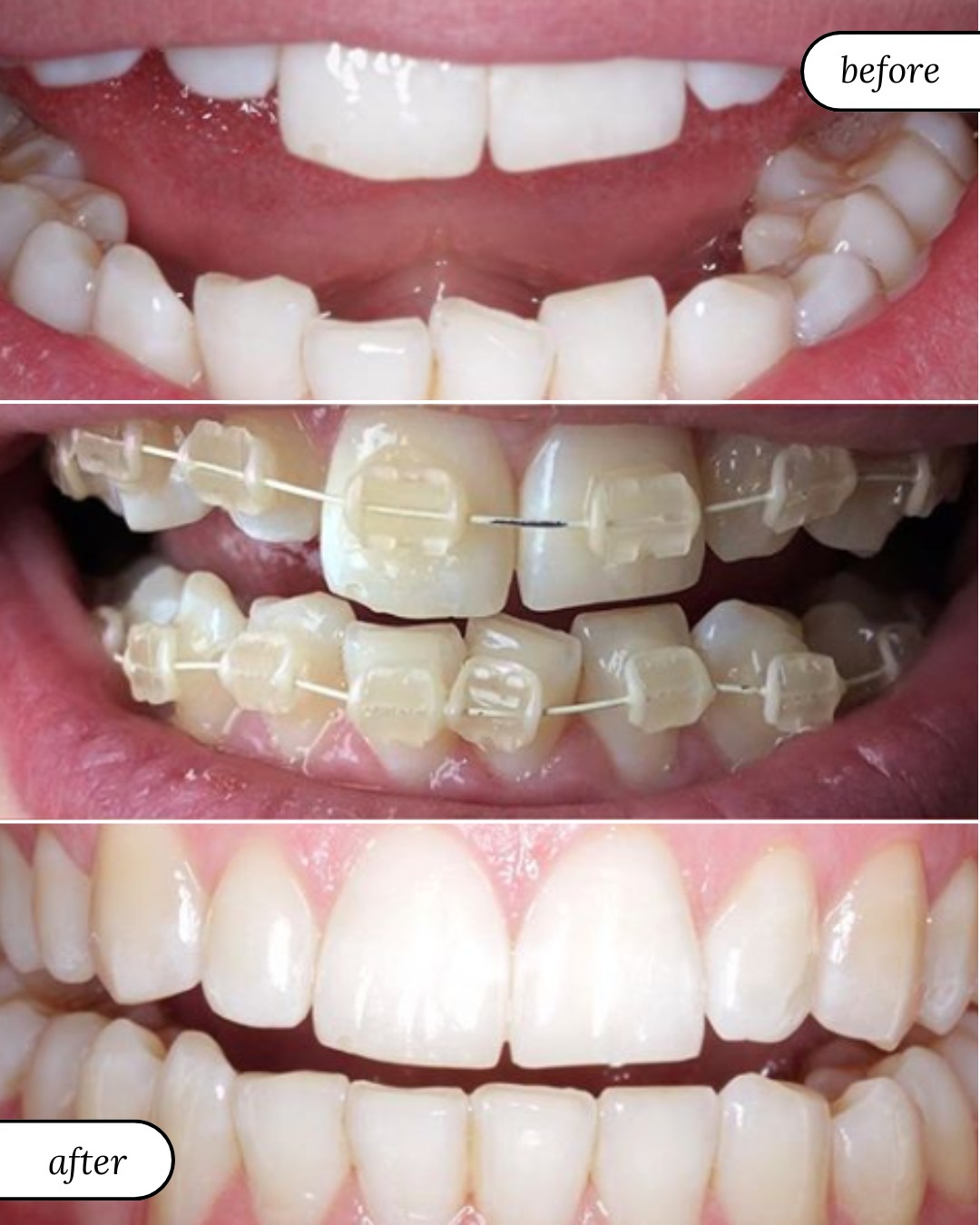 Smile Gallery