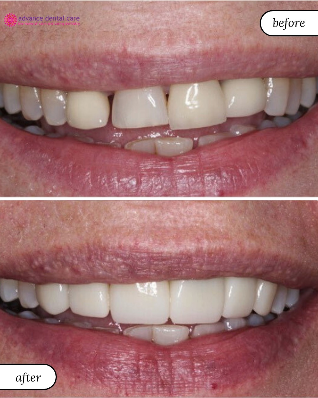 Smile Gallery