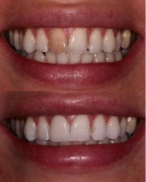 Advance Dental Care, Barry