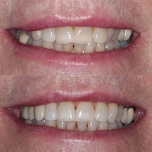 Advance Dental Care, Barry