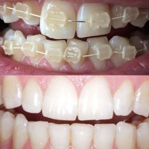 Advance Dental Care, Barry